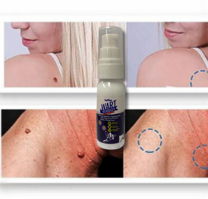 WART REMOVER (30 ml)