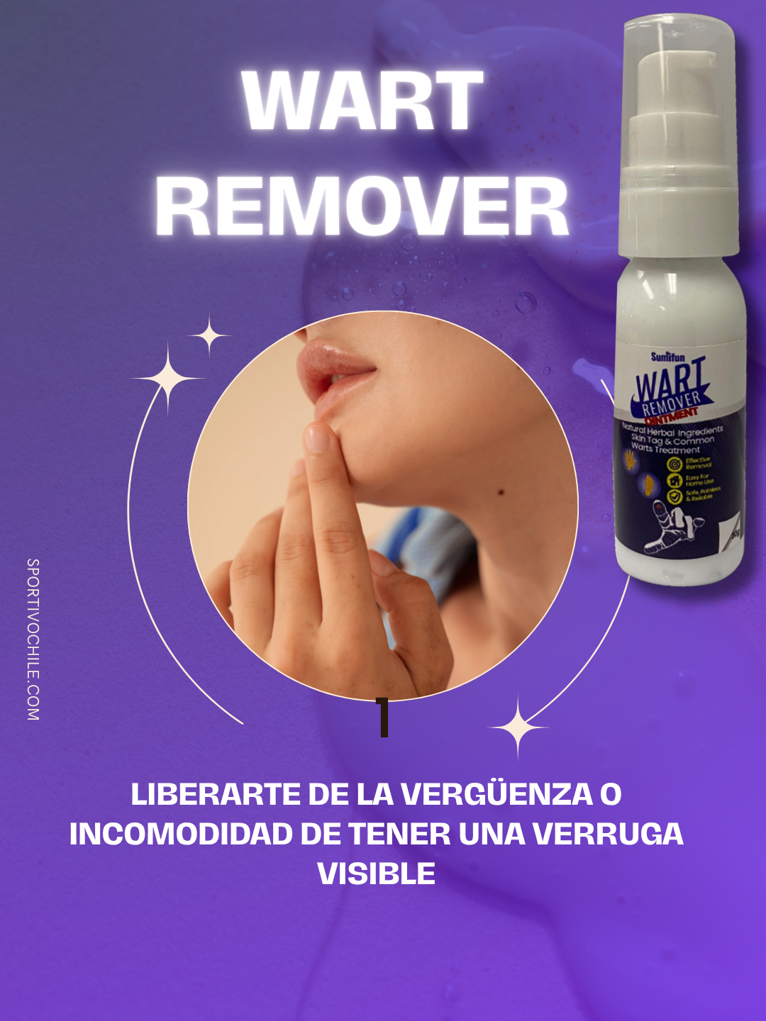 WART REMOVER (30 ml)